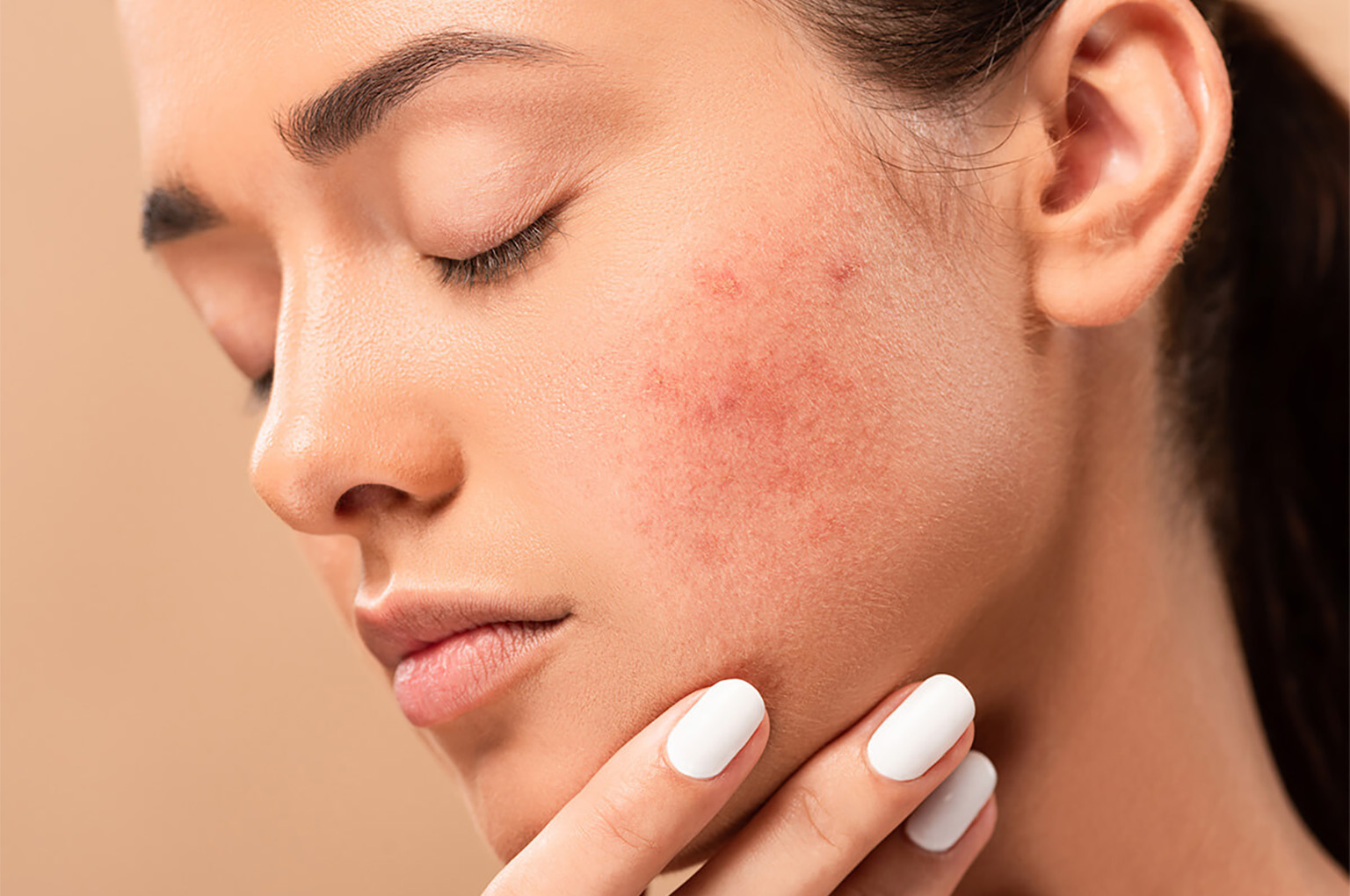 Topical Treatments for Scars